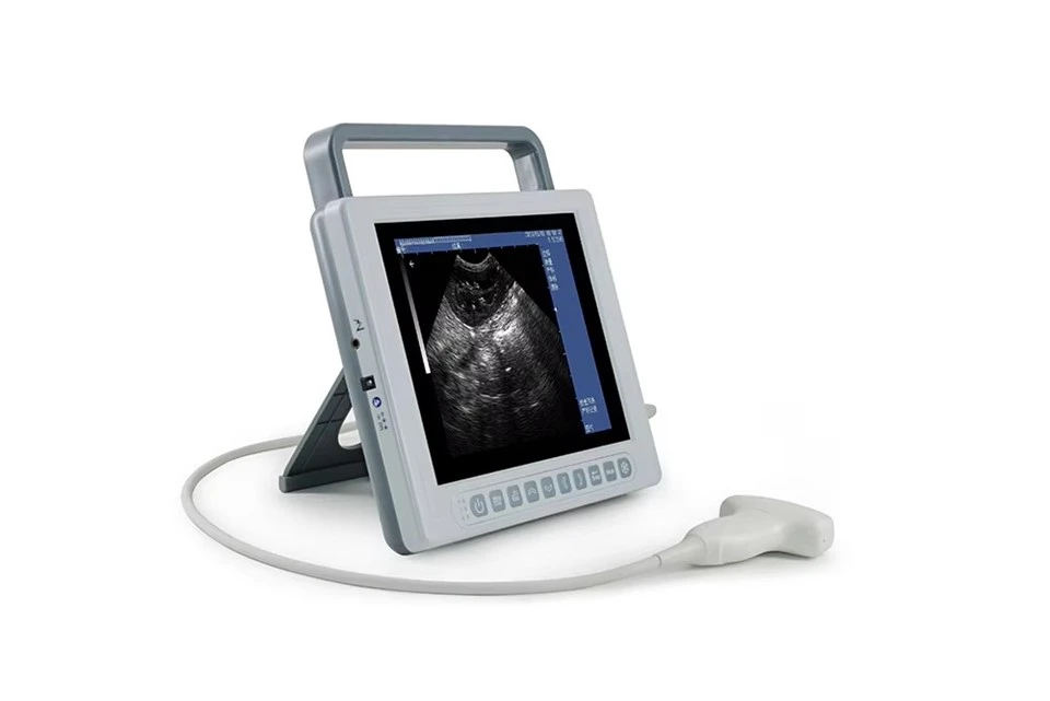 FTL-UV10 Portable Ultrasound Machine – Full Digital B-Mode Scanner factory