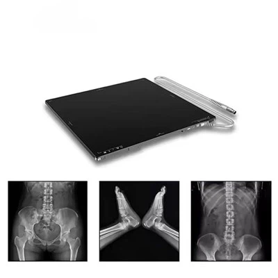 V1717X แผงตรวจจับ