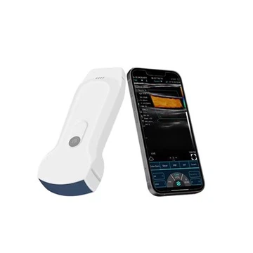3 in 1 MultiPurpose Wireless Ultrasound Probe Color Doppler