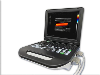 Notebook Color Doppler FTL-UTS100